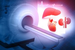 МРТ сердца: что показывает, показания, подготовка к исследованию