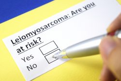 Лейомиосаркома: симптомы, современные методы лечения