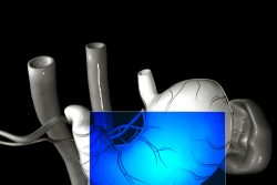 МРТ желудка: показания, подготовка, методика проведения исследования