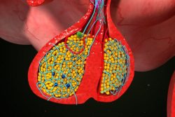 Опухоль гипофиза: симптомы, лечение, профилактика