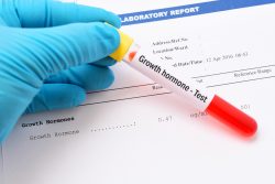 Гормон СТГ: функции, норма в крови, причины нарушений