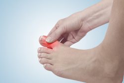Подагра: признаки и лечение у мужчин и женщин