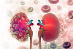 Туберкулез почек: симптомы, методы диагностики, лечение