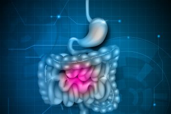 Cиндром короткой кишки: почему возникает и как лечить