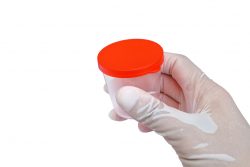 Как сдавать мокроту на анализ