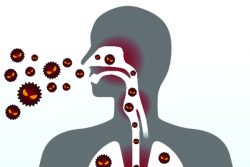 Лечение острого бронхита в домашних условиях