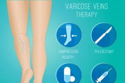 Лечение варикозного расширения вен в домашних условиях