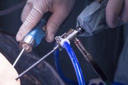 Что такое артроскопия: когда она показана, методика