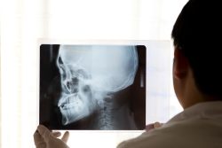 Рентген турецкого седла: показания, противопоказания, методика проведения