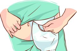 Как правильно ухаживать за стомой – практические советы и средства для ухода