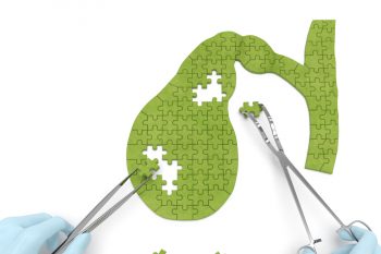 Осложнения острого холецистита