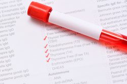 Анализ на гормоны щитовидной железы: как сдавать?