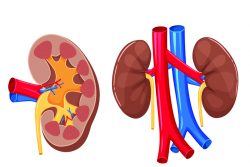 Гидрокаликоз почек: причины, симптомы, лечение