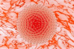 Венерическая лимфогранулема – что за болезнь, симптомы и лечение