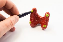 Гиперпаратиреоз: виды, симптомы и лечение