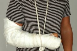 Переломы, виды переломов, первая помощь