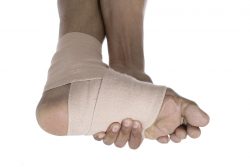 Как лечить растяжение связок