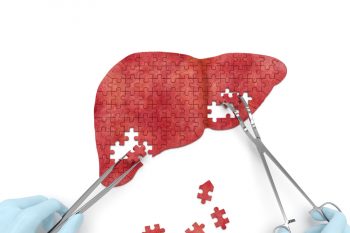 Гемангиома печени — лечение