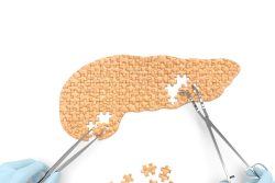Какие ферменты помогут при панкреатите — что лучше выбрать?