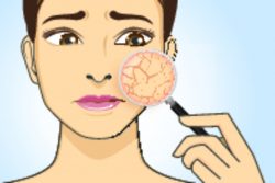 Наиболее распространенные заболевания кожи