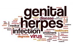 Герпес половой – лечение
