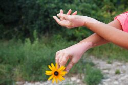 Лейкодерма: причины появления, симптомы и лечение