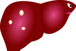 Простая киста печени: причины и лечение