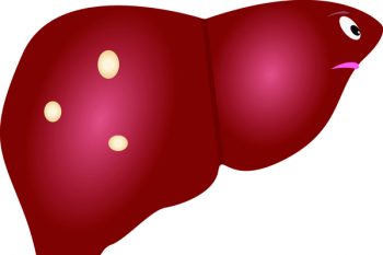 Простая киста печени: причины и лечение