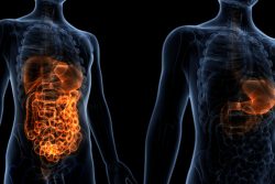 Болезни кишечника: причины, патогенез, симптомы