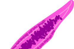 Описторхоз — что это такое? Симптомы, диагностика и лечение