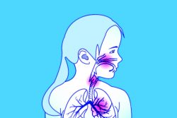 Пневмония у детей: причины, симптомы и лечение