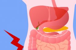 Флегмонозный аппендицит: признаки и операция по удалению аппендицита