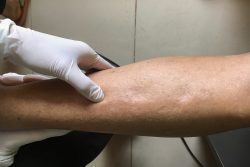 Что делать, если отекают ноги