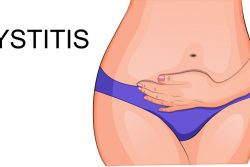 Рецидивирующий цистит: причины и лечение