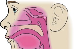 Синуситы у детей: причины, симптомы и профилактика