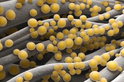 Везикулопустулез новорожденных: симптомы и лечение