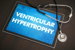 Гипертрофия правого желудочка: причины, симптомы, лечение