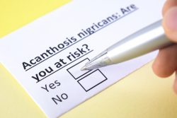 Черный акантоз: причины, симптомы и лечение