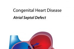 Открытое овальное окно в сердце: причины, симптомы, лечение и прогнозы