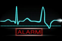 Экстрасистолия: симптомы и лечение