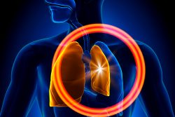 Пневмоторакс: причины, симптомы и неотложная помощь