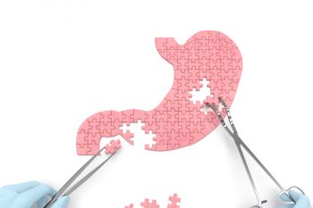 Полип желудка – симптомы и лечение