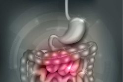 Болезнь Крона: симптомы и лечение