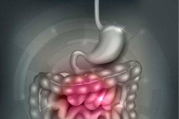 Болезнь Крона: симптомы и лечение