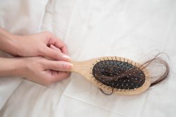 Андрогенная алопеция у женщин: причины и лечение