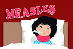 Корь у детей: симптомы и лечение