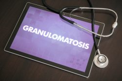 Гранулематоз Вегенера