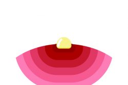 Фурункулы: причины и лечение