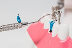 Уход за зубными протезами