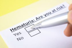 Гематурия у мужчин и женщин: что это такое, причины
